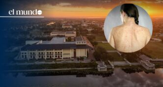 Measles outbreak in Florida: Ave Maria University confirms 60 cases